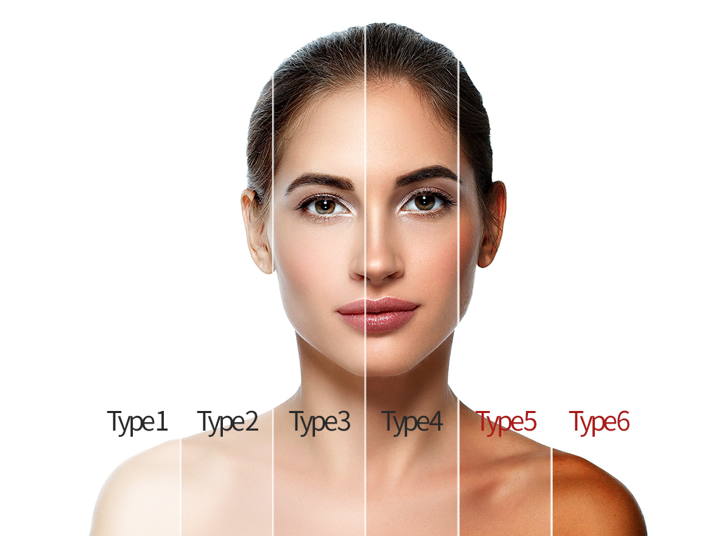 Fitzpatrick Skin Types