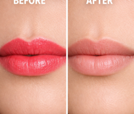 Before and after image of lip blush removal