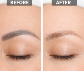Before and after image of microblading removal